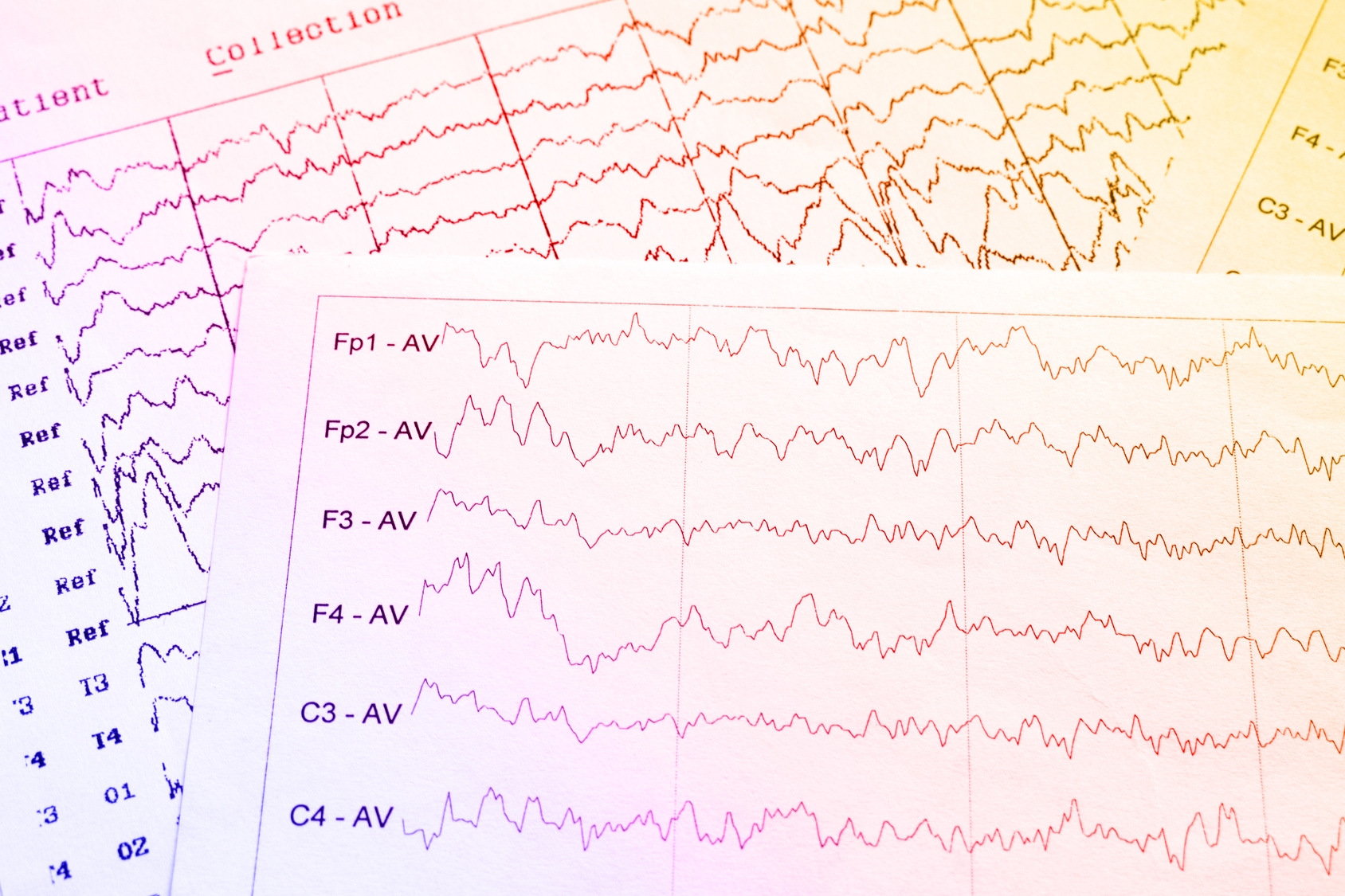 Was Ist Ein EEG? | Praxis Für Psychotherapie Heinz-Werner Bähr/Anke ...